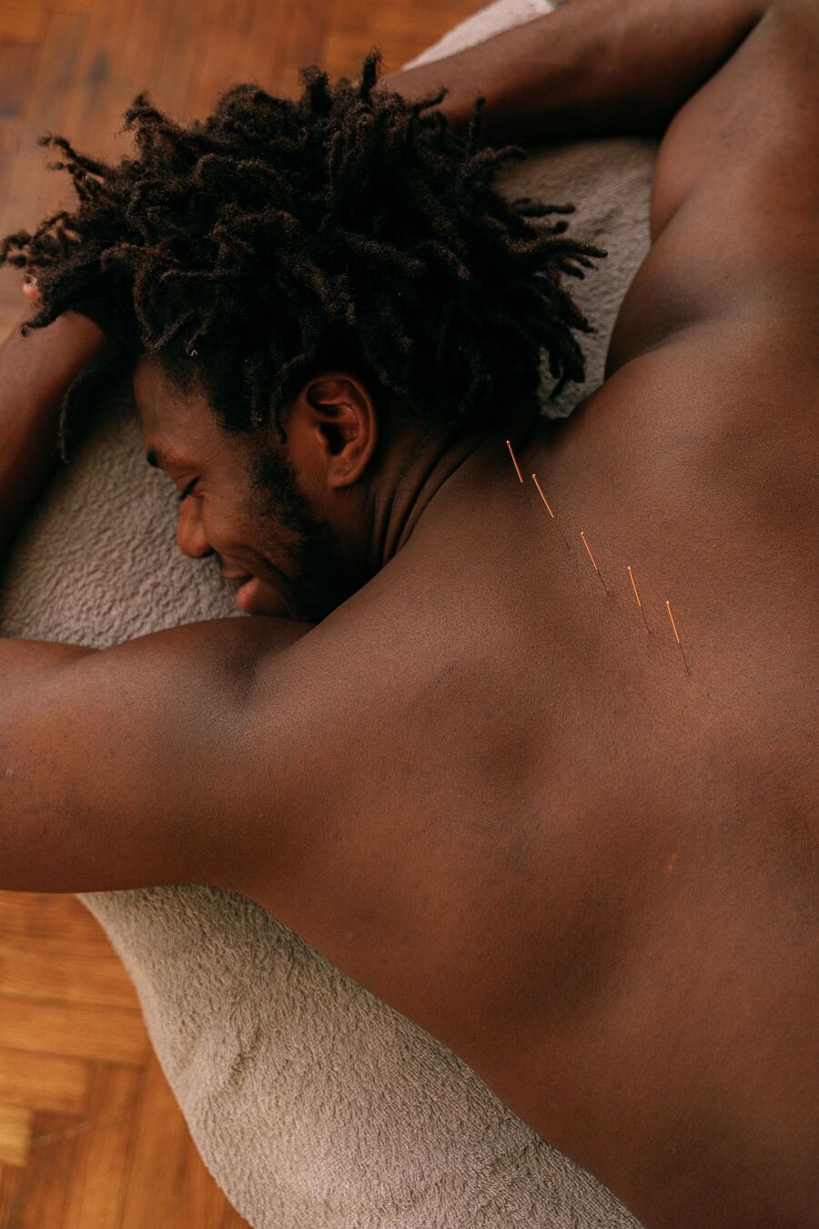 Patient relaxing face down during a body acupuncture session in Morristown NJ