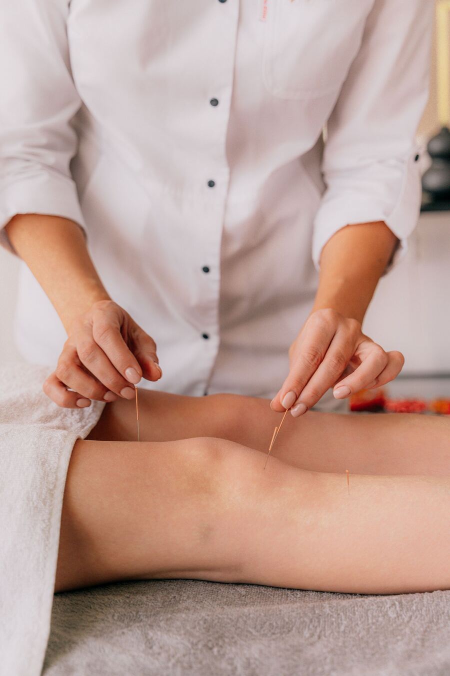 Acupuncturist placing needles around the knee to treat knee pain and arthritis