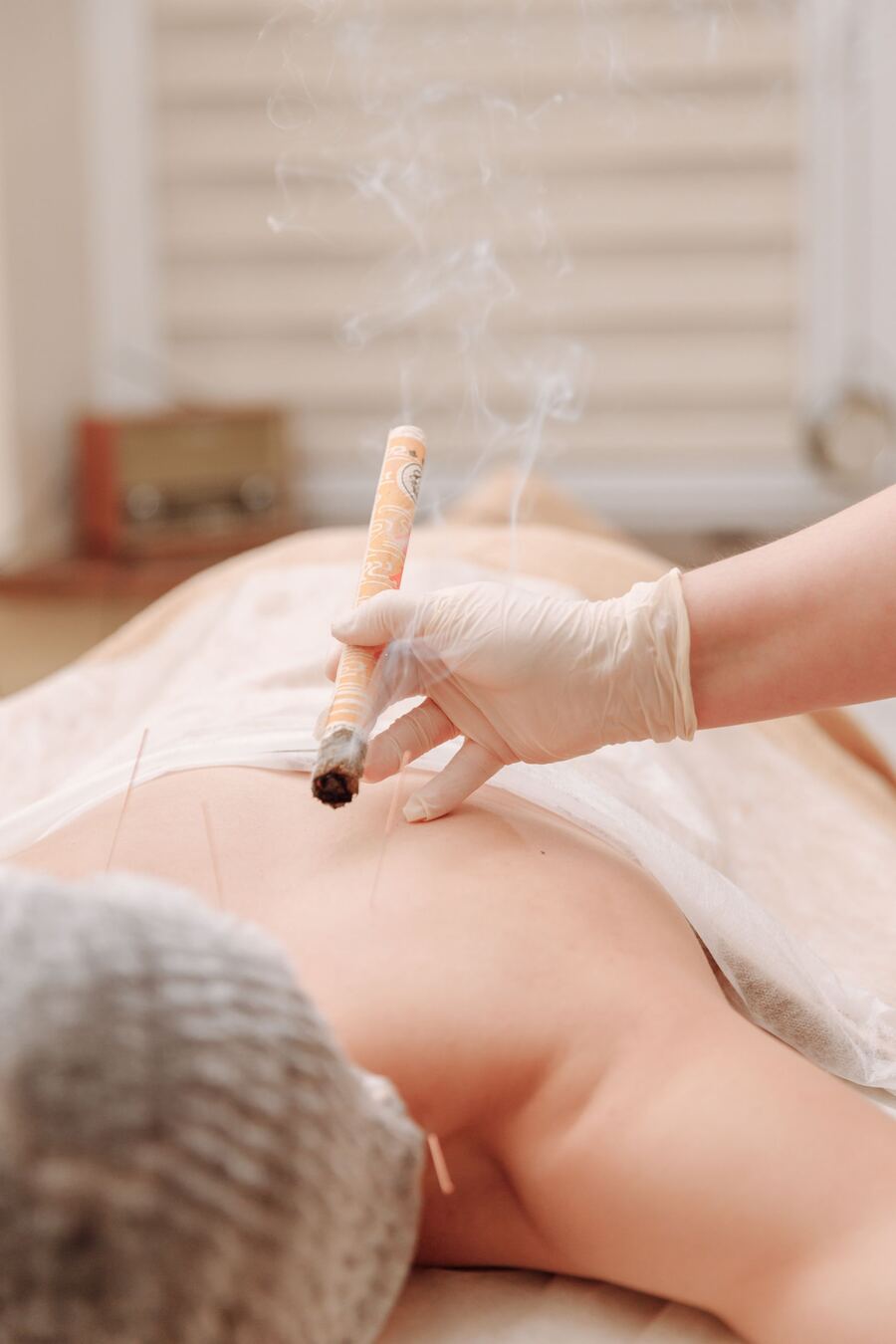 Moxibustion with a warming moxa stick held over acupuncture points